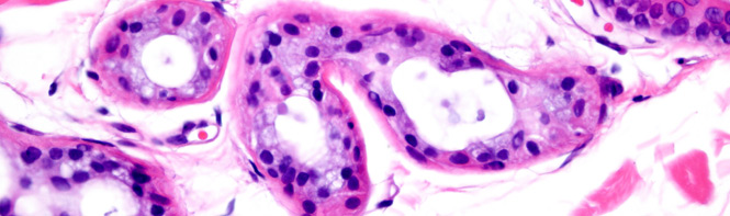 Skin Cells