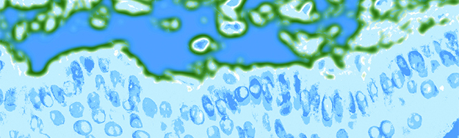Skin cells
