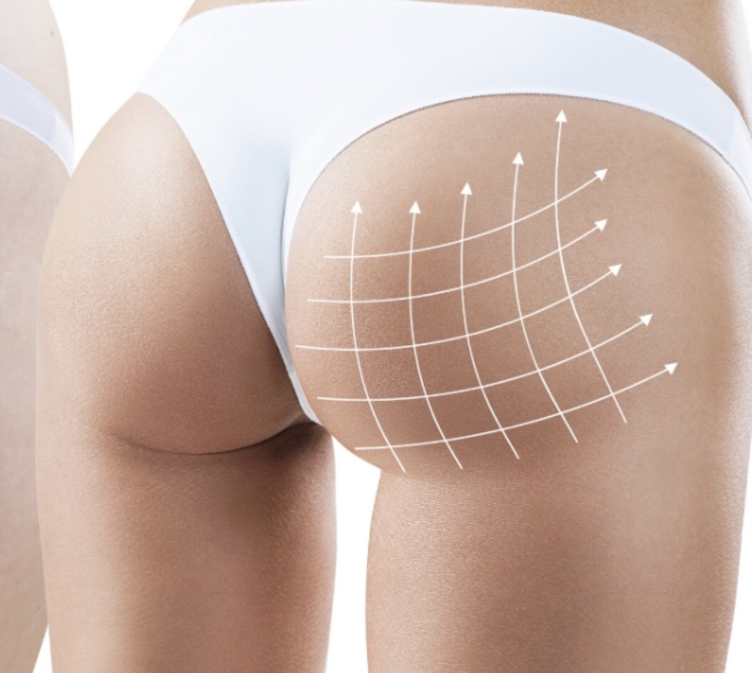 About tummy tightening and butt lifting creams – sense or nonsense?