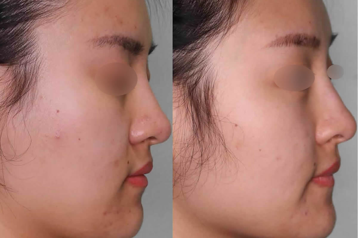 Get a skin consultation in London