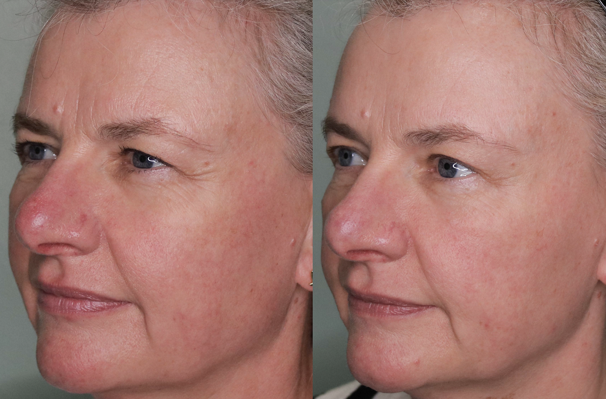 Get a skin consultation in London