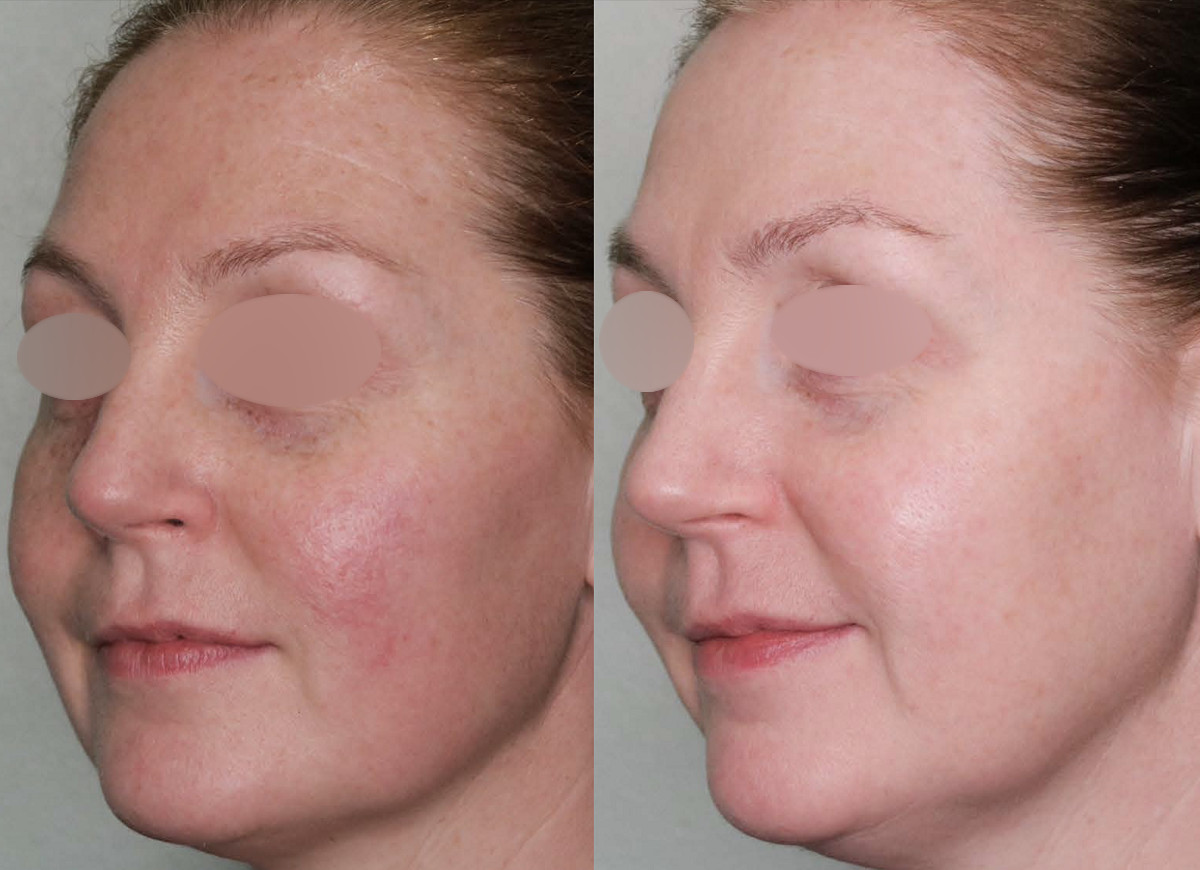 Get a skin consultation in London