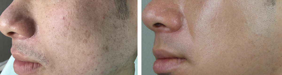 Get a skin consultation in London