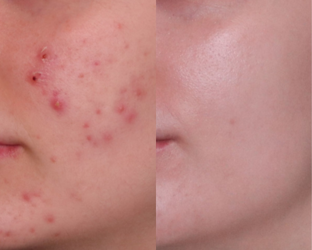 Get a skin consultation in London