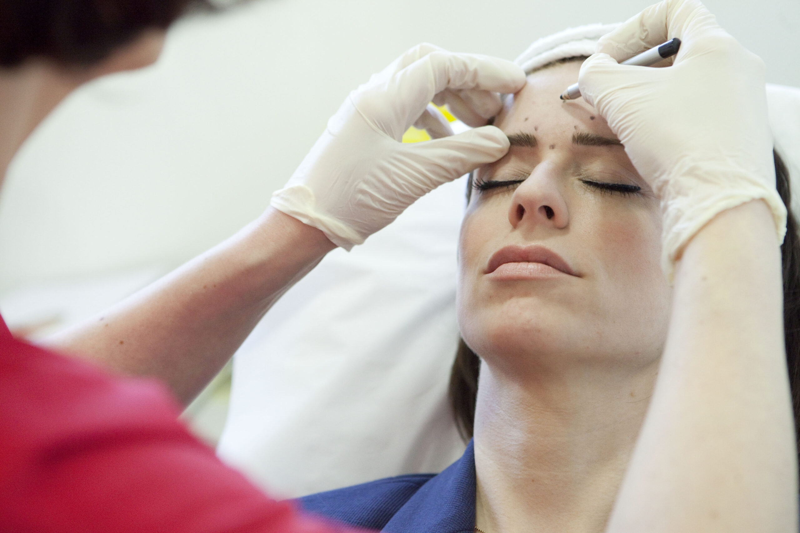 Low Dose Botox London