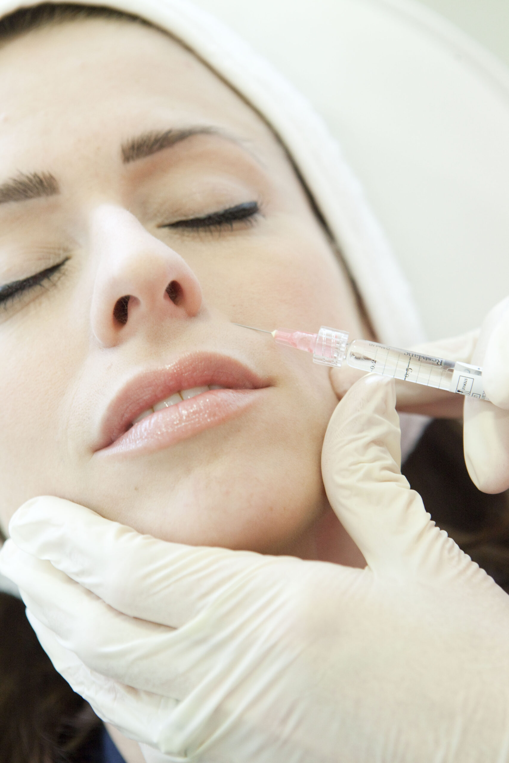 Dermal filler injection technique at Eudelo London